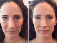 Массаж лица, фотография 2