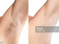 Профессиональные массаж и депиляция у меня дома в Ташкенте., фотография 4