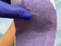 Депиляция Эпиляция Шугаринг., фотография 2