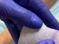 Депиляция Эпиляция Шугаринг., фотография 3