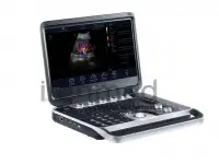 Портативная ультразвуковая диагностическая система Finus 50 с цветным доплером, фотография 5