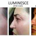 Aнтивозрастной luminesce™ дневной увлажняющий комплекс, фотография 2