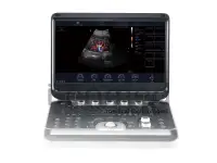 Портативная ультразвуковая диагностическая система Finus 50 с цветным доплером, фотография 3