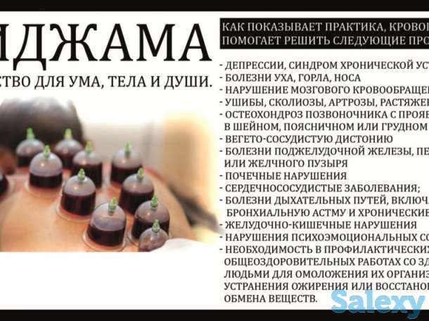 Кровопускание хиджама, фотография 2