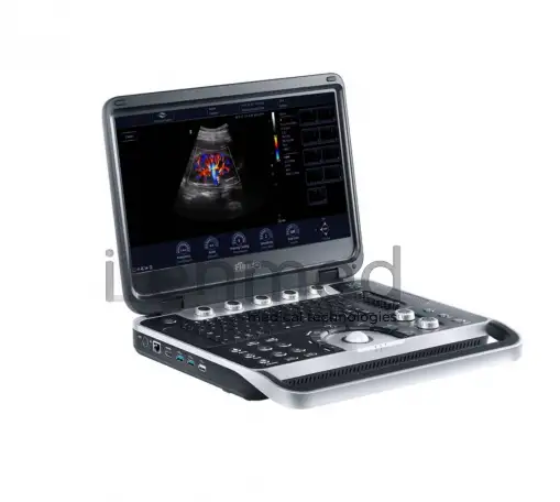 Портативная ультразвуковая диагностическая система Finus 50 с цветным доплером, фотография 5