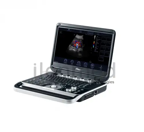 Портативная ультразвуковая диагностическая система Finus 50 с цветным доплером, фотография 1