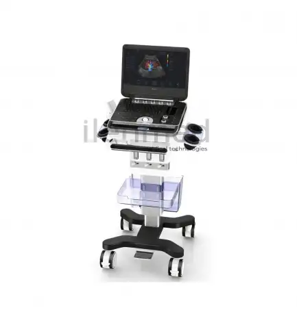 Портативная ультразвуковая диагностическая система Finus 50 с цветным доплером, фотография 2