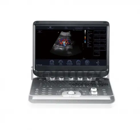 Портативная ультразвуковая диагностическая система Finus 50 с цветным доплером, фотография 3