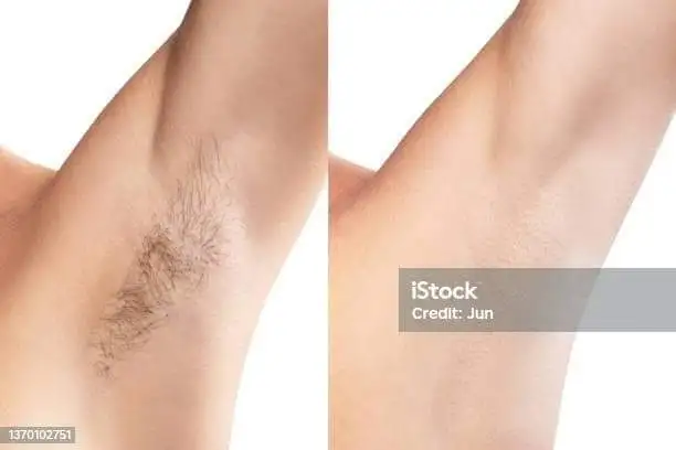 Профессиональные массаж и депиляция у меня дома в Ташкенте., фотография 4