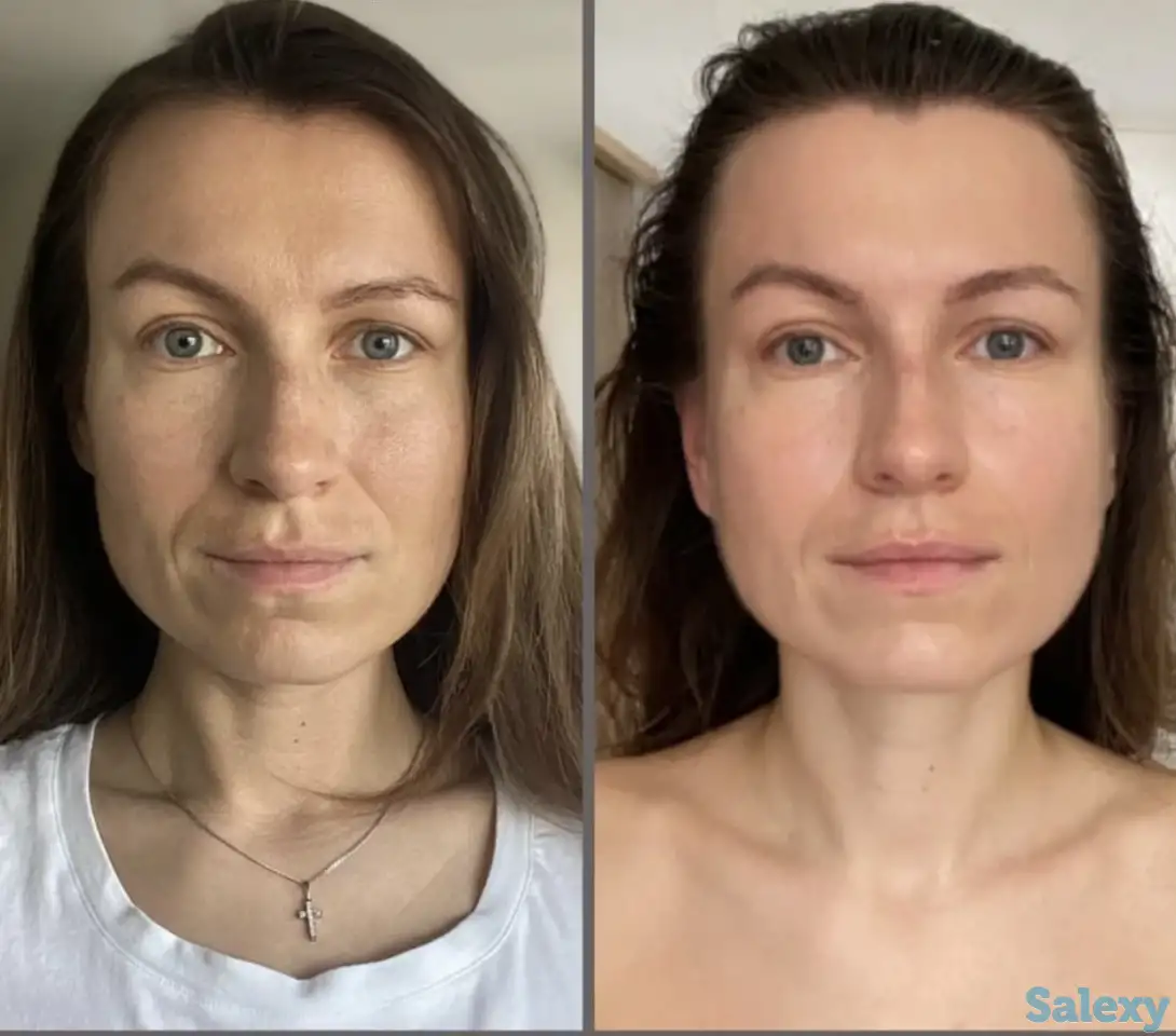 Скульптурный массаж лица, фотография 3