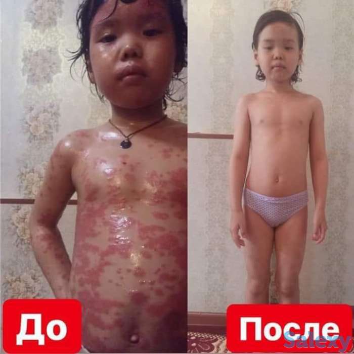 КоэнзимQ10. Омоложение клеток, органов, систем и внешности на 10 - 15 лет!, фотография 9