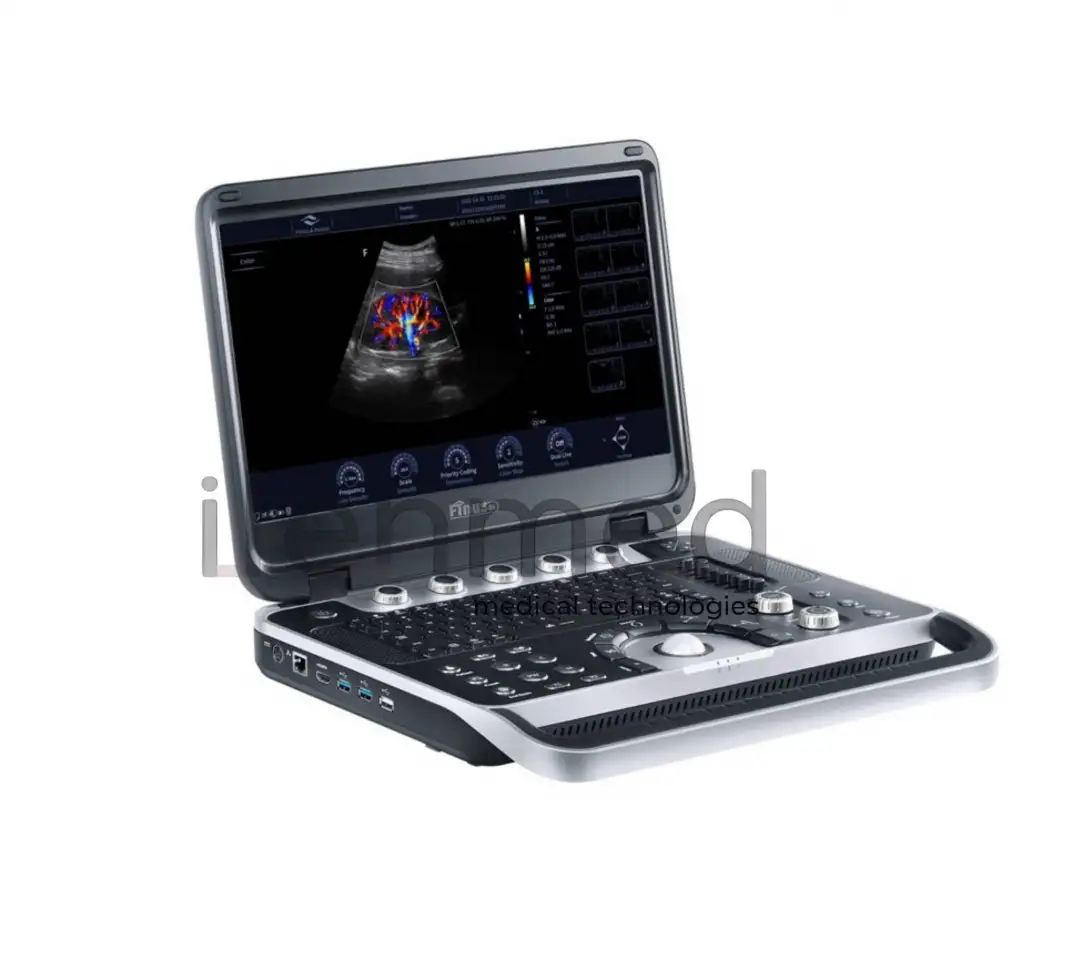 Портативная ультразвуковая диагностическая система Finus 50 с цветным доплером, фотография 5