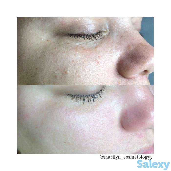 Королева гладкой кожи Ташкент!, фотография 1