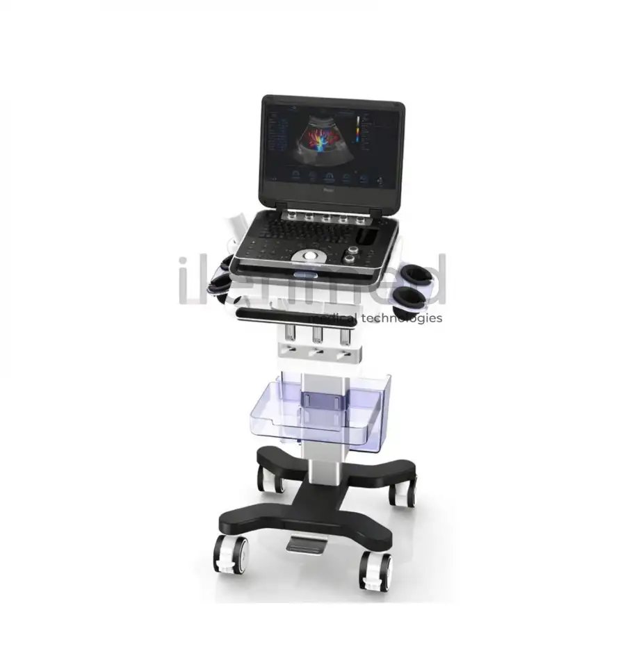 Портативная ультразвуковая диагностическая система Finus 50 с цветным доплером, фотография 2