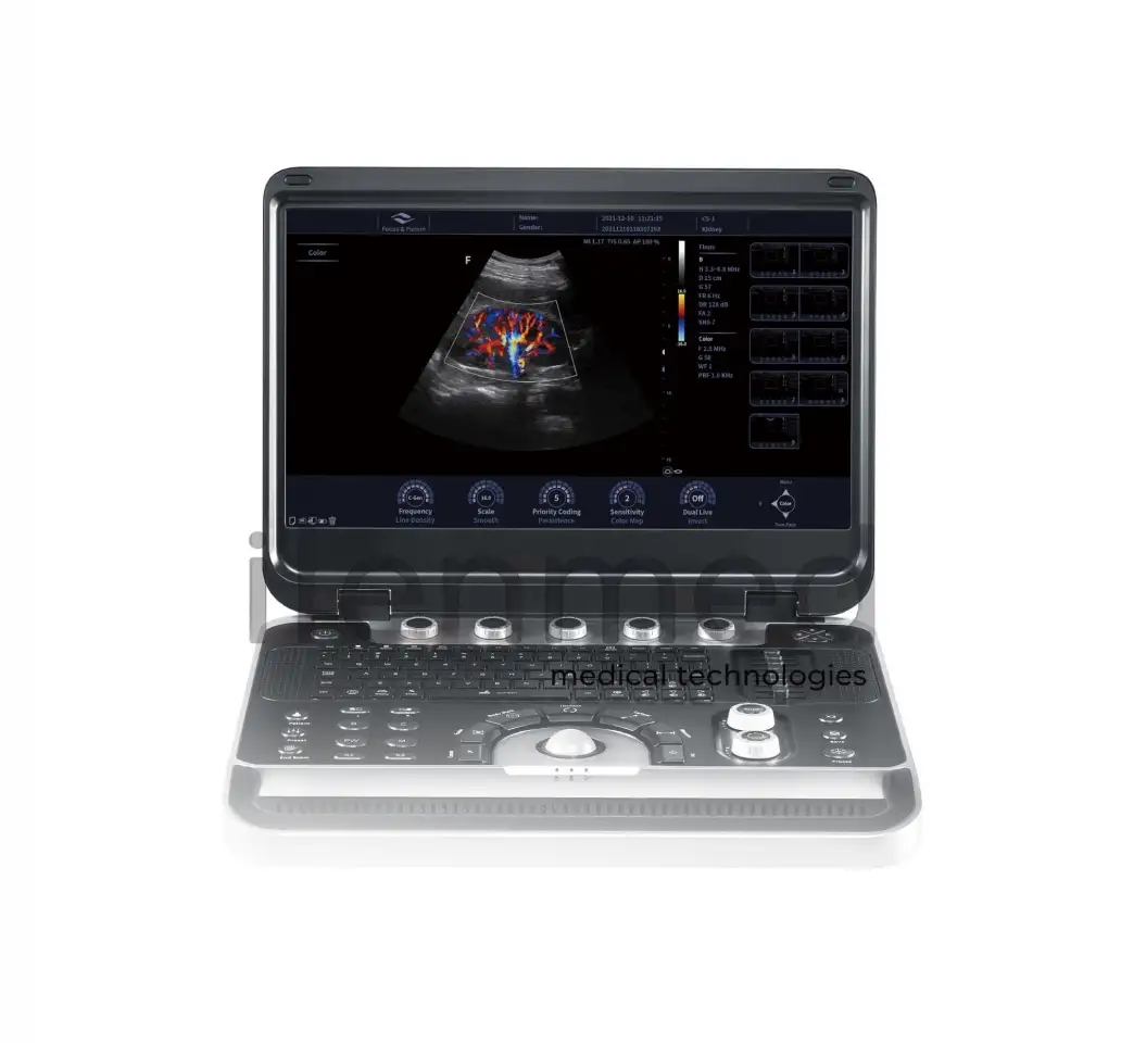 Портативная ультразвуковая диагностическая система Finus 50 с цветным доплером, фотография 3
