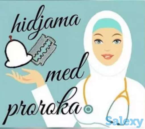 Кровопускание хиджама, фотография 1