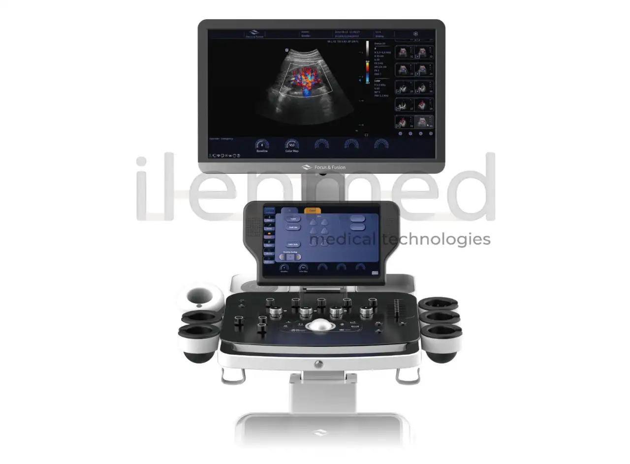 Стационарный УЗИ-аппарат Danus 10 среднего-высокого класса, фотография 2